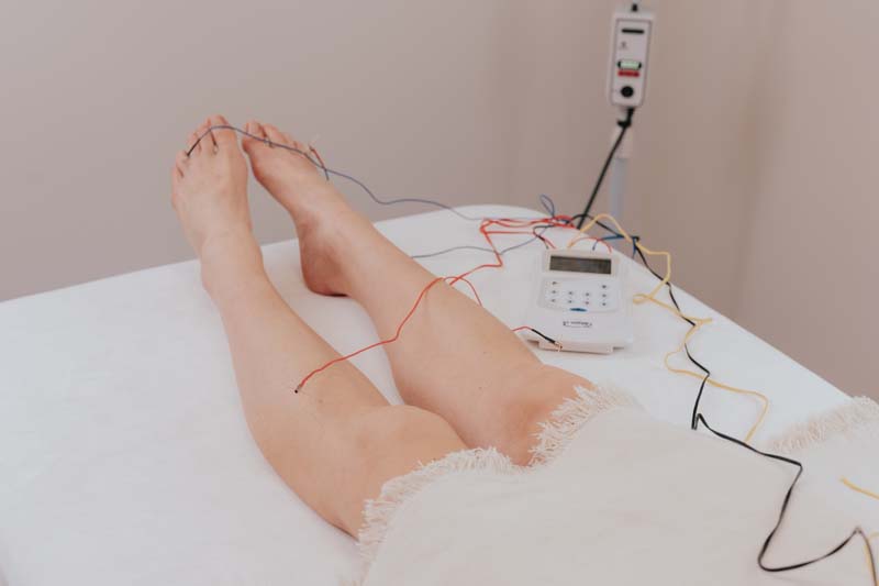 acupuncture - électroacupuncture