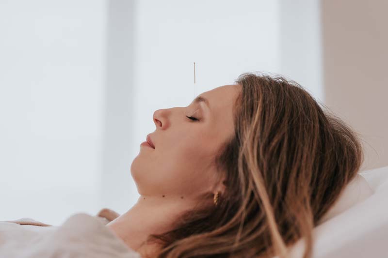 acupuncture - les aiguilles