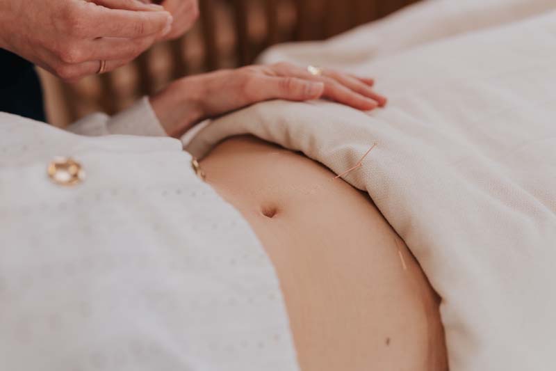 Acupuncture et fertilité